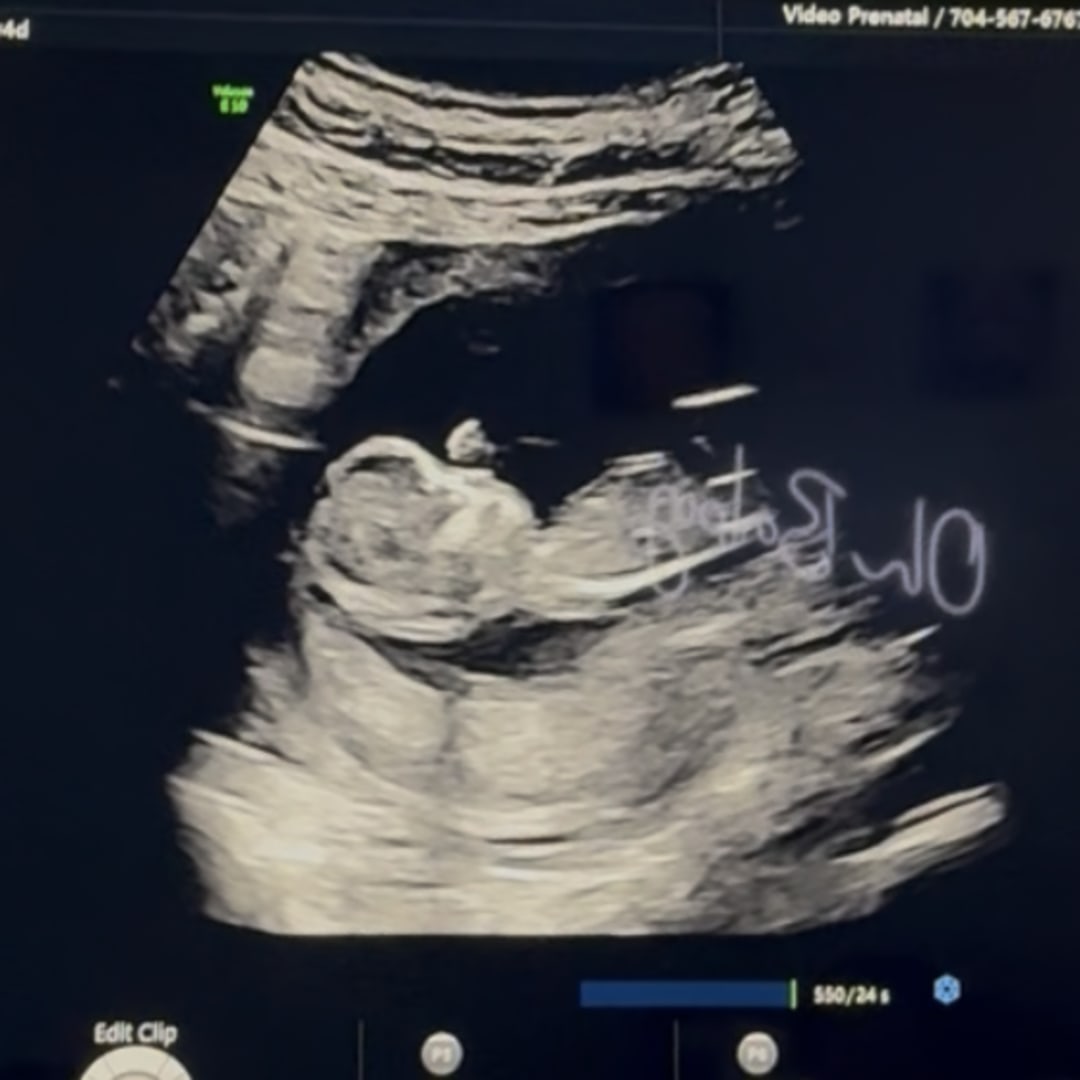 Photo shared by Toniq for their Babylist baby registry.