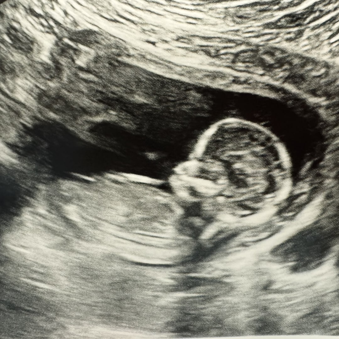 Photo shared by Haley for their Babylist baby registry.