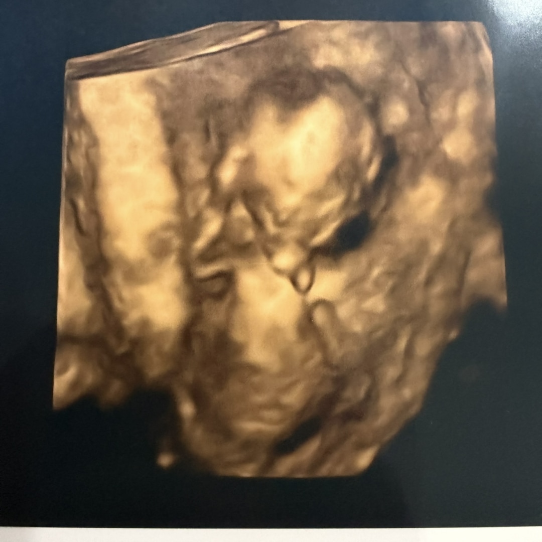 Photo shared by Alexis for their Babylist baby registry.