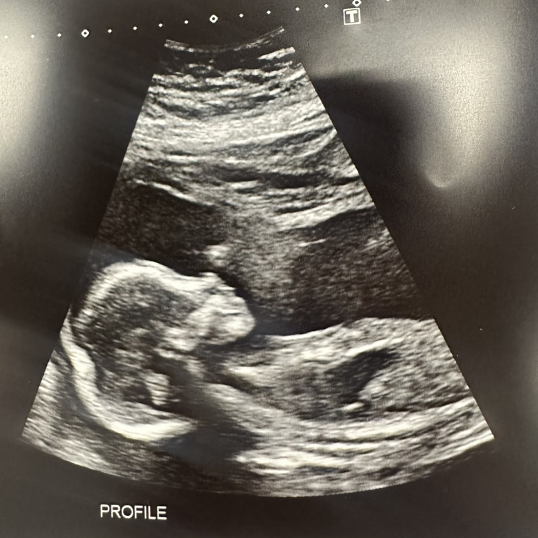 Photo shared by Christina for their Babylist baby registry.