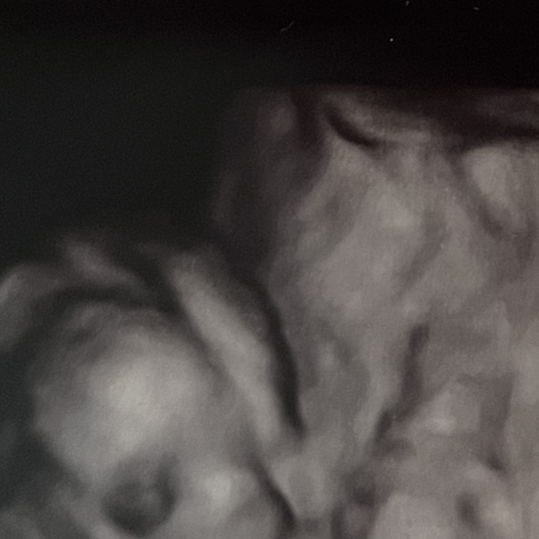 Photo shared by Raven for their Babylist baby registry.