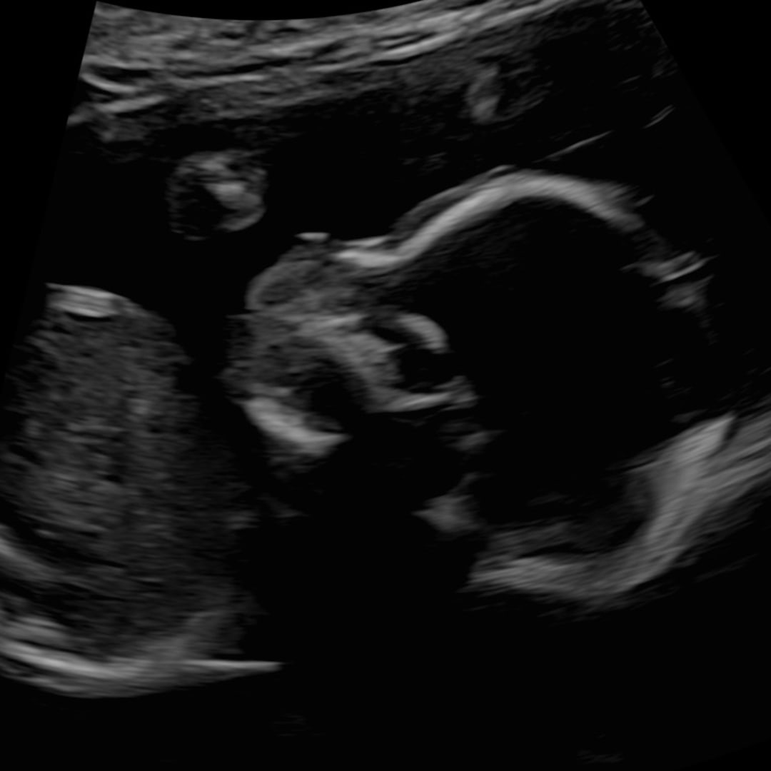 Photo shared by Erin for their Babylist baby registry.