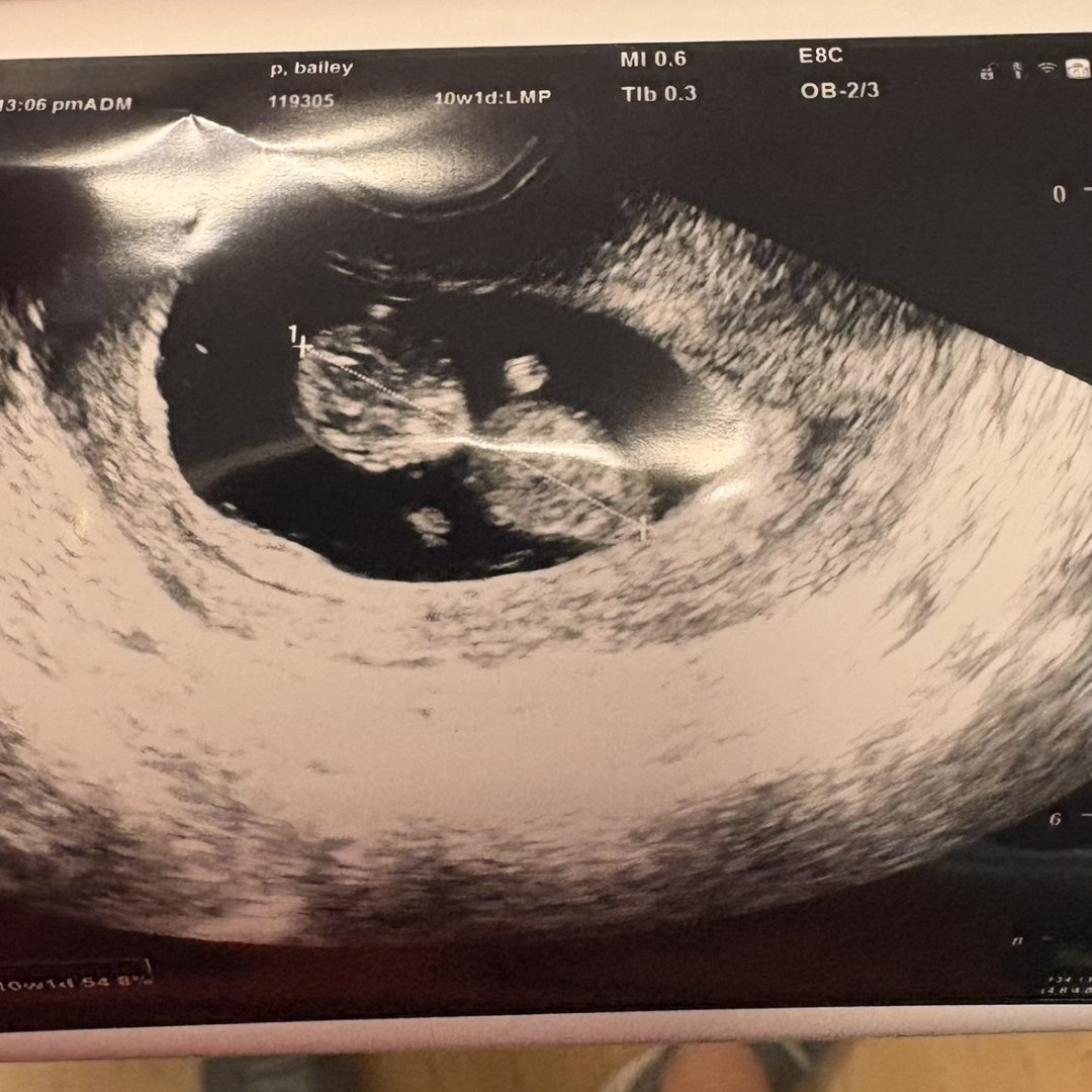 Photo shared by Baileigh for their Babylist baby registry.