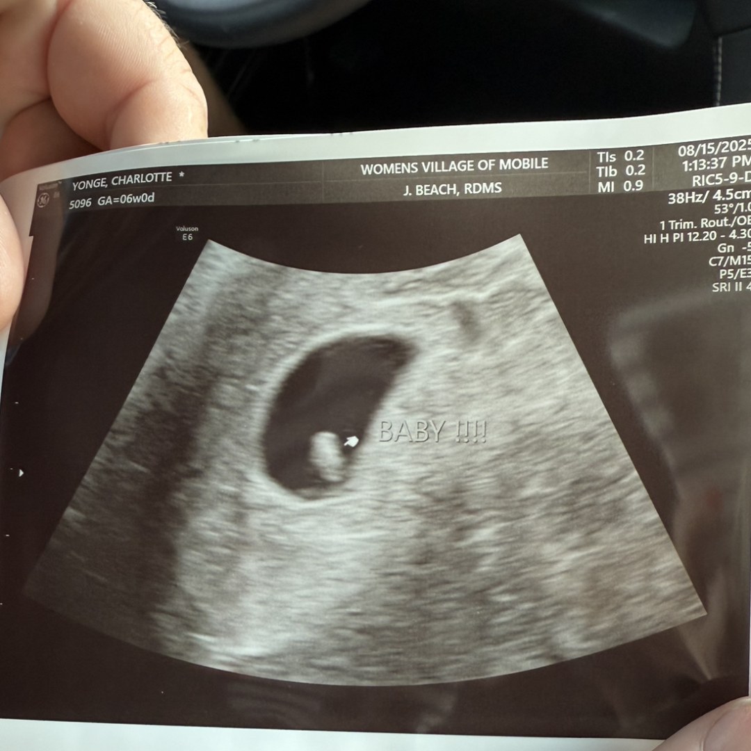 Photo shared by Charlotte for their Babylist baby registry.