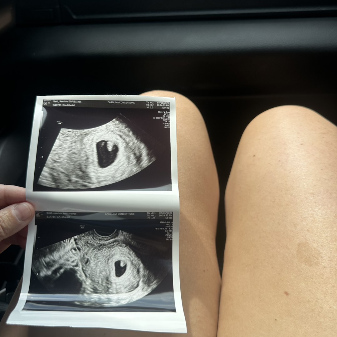Photo shared by Jessica for their Babylist baby registry.
