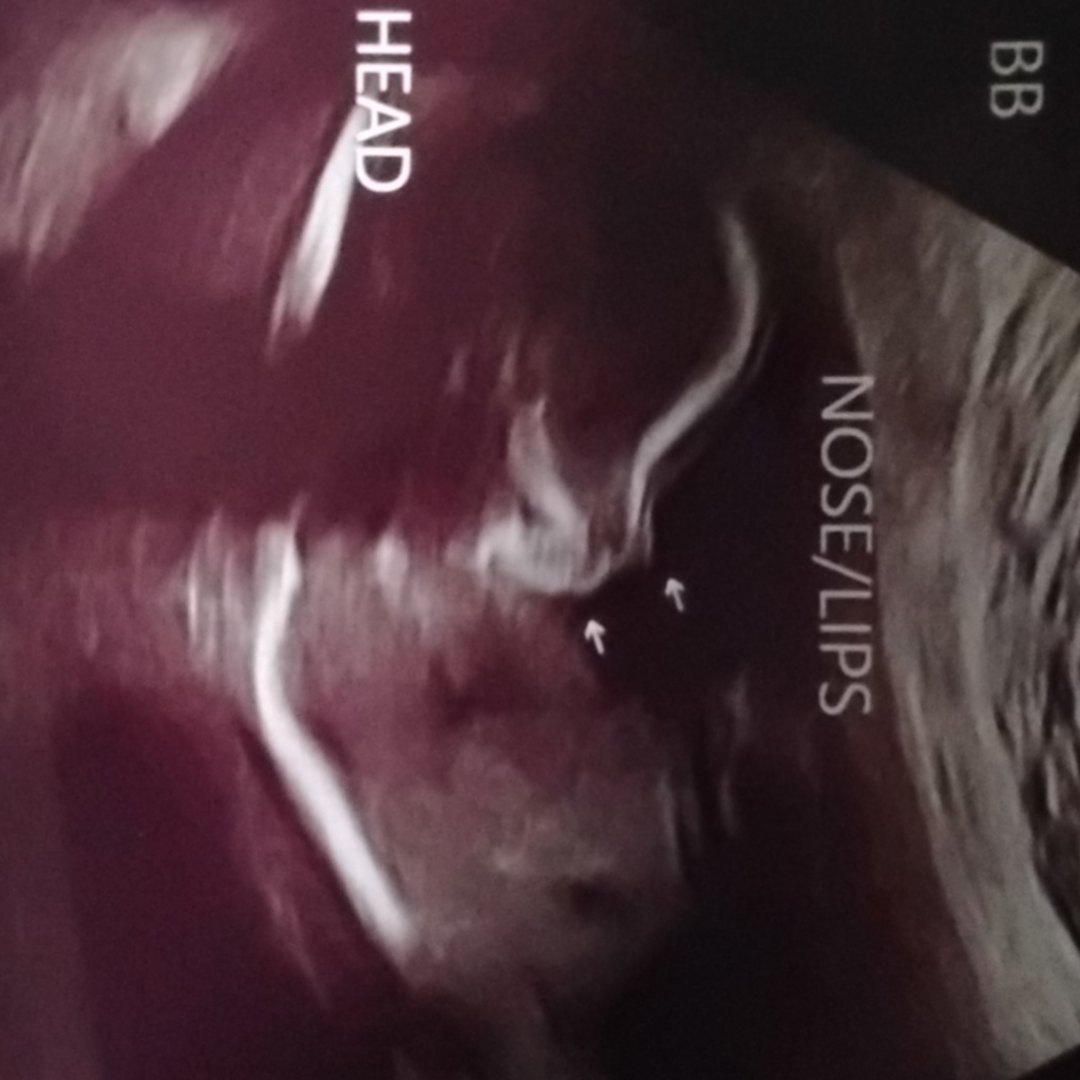 Photo shared by Honey for their Babylist baby registry.