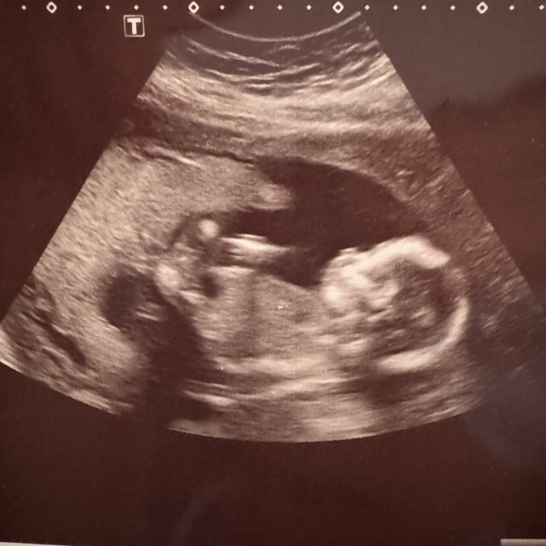 Photo shared by Elizabeth for their Babylist baby registry.