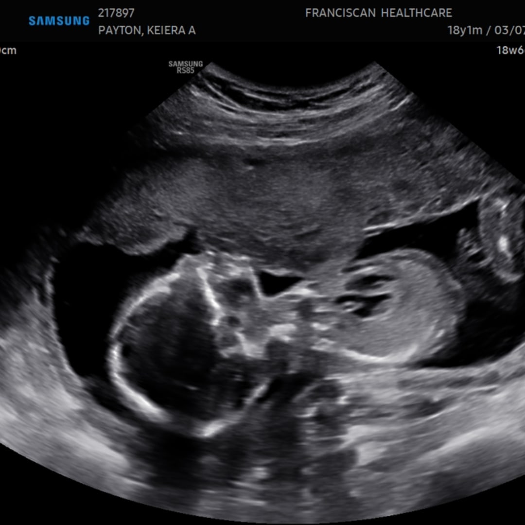 Photo shared by Keiera for their Babylist baby registry.
