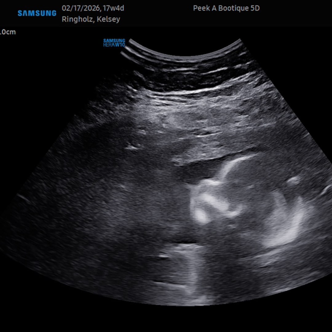 Photo shared by Kelsey for their Babylist baby registry.