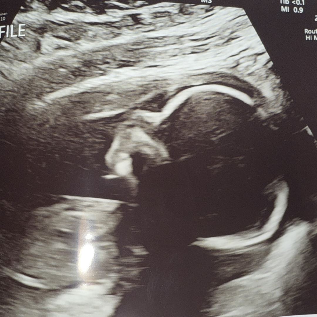 Photo shared by Rosa for their Babylist baby registry.