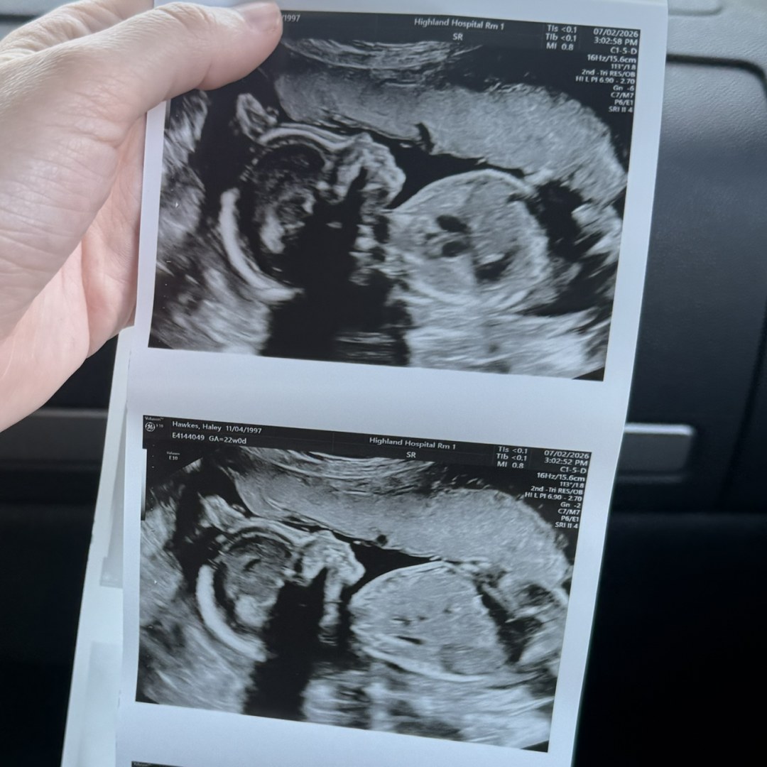 Photo shared by Haley for their Babylist baby registry.