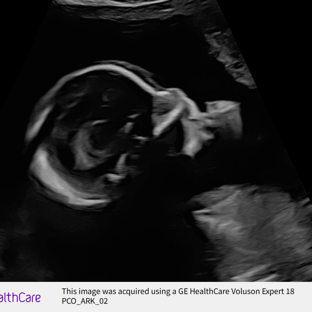 Photo shared by Deissy for their Babylist baby registry.