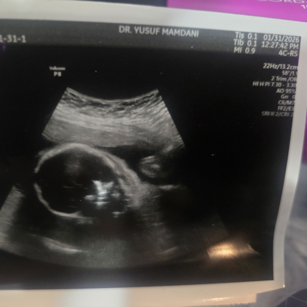 Photo shared by Breanna for their Babylist baby registry.