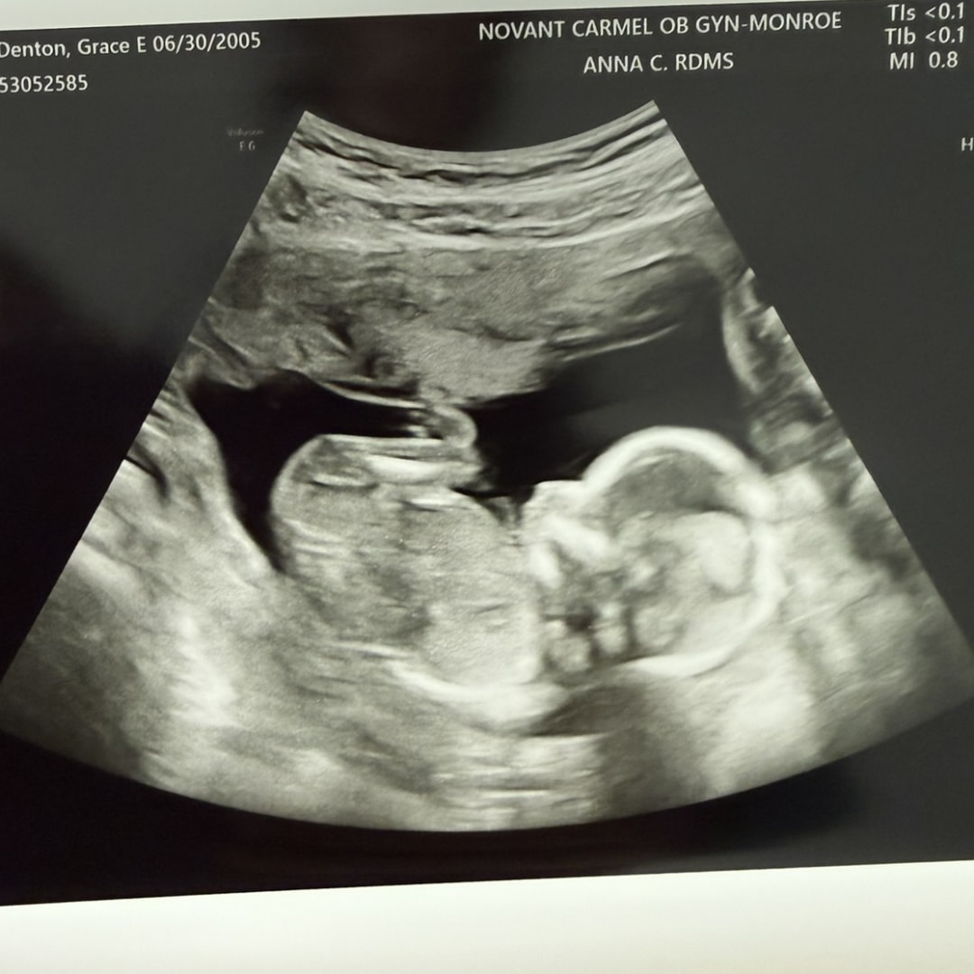 Photo shared by Grace for their Babylist baby registry.