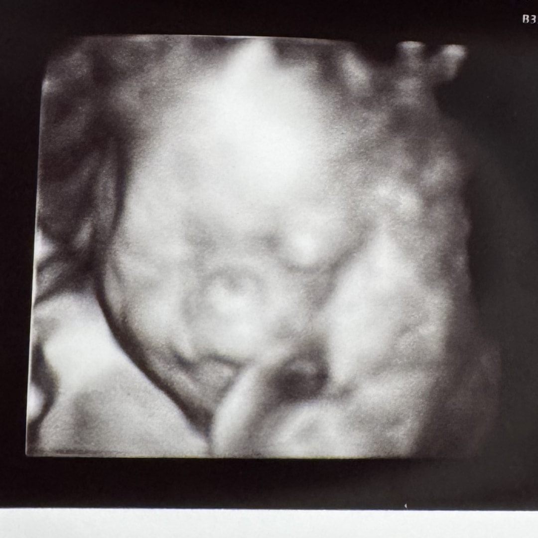 Photo shared by Ebanya (Abby) for their Babylist baby registry.