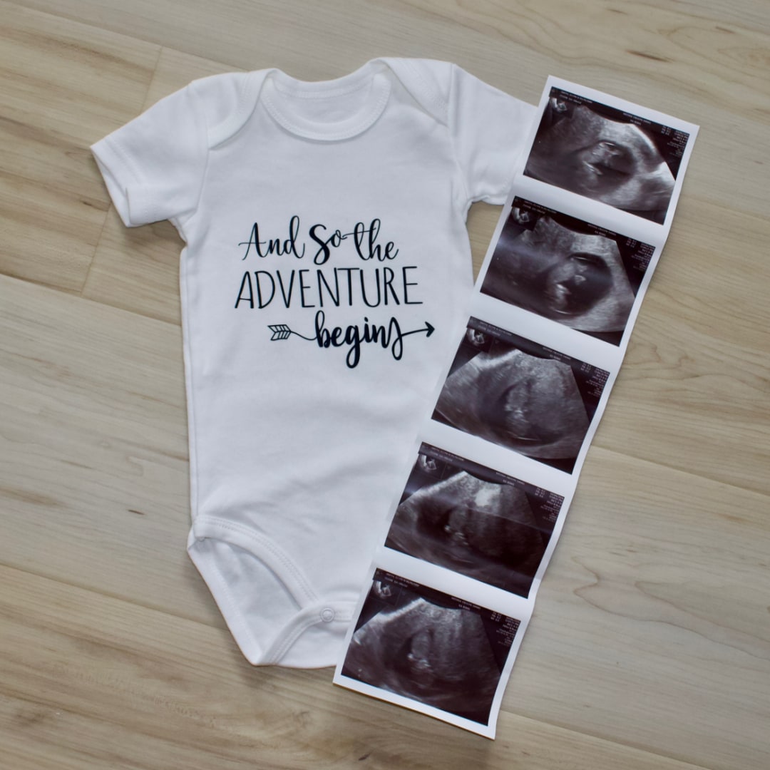 Photo shared by Elly for their Babylist baby registry.