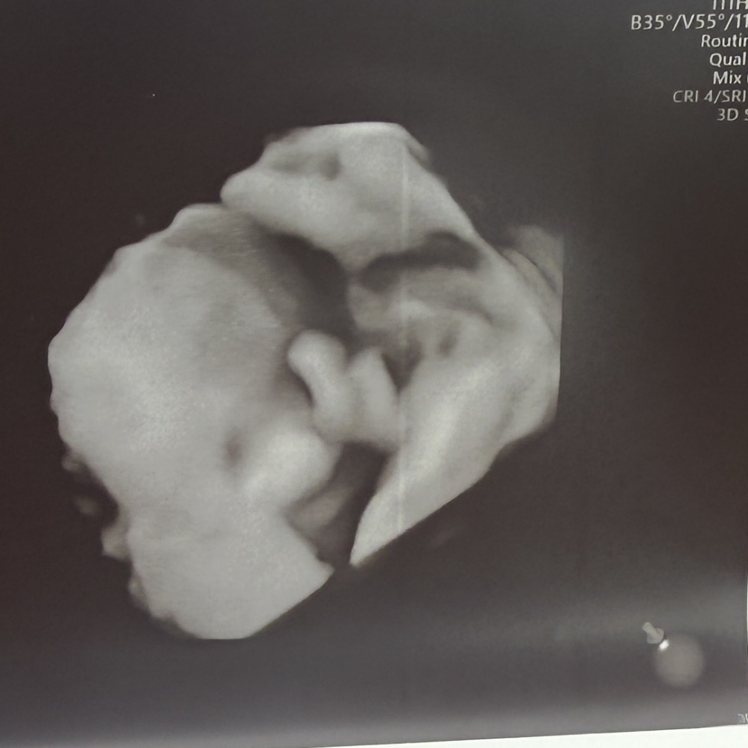 Photo shared by Ashley for their Babylist baby registry.