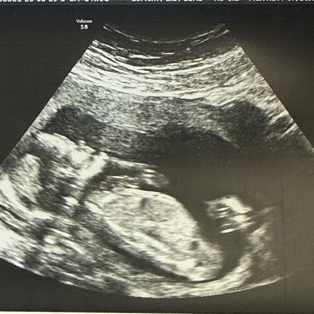 Photo shared by Hannah for their Babylist baby registry.