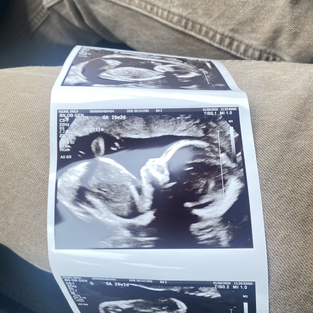 Photo shared by Erica for their Babylist baby registry.