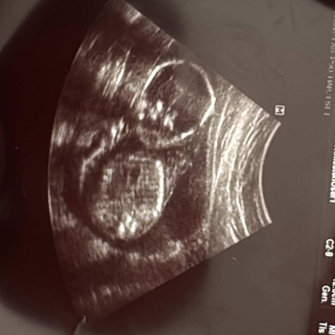 Photo shared by Star for their Babylist baby registry.