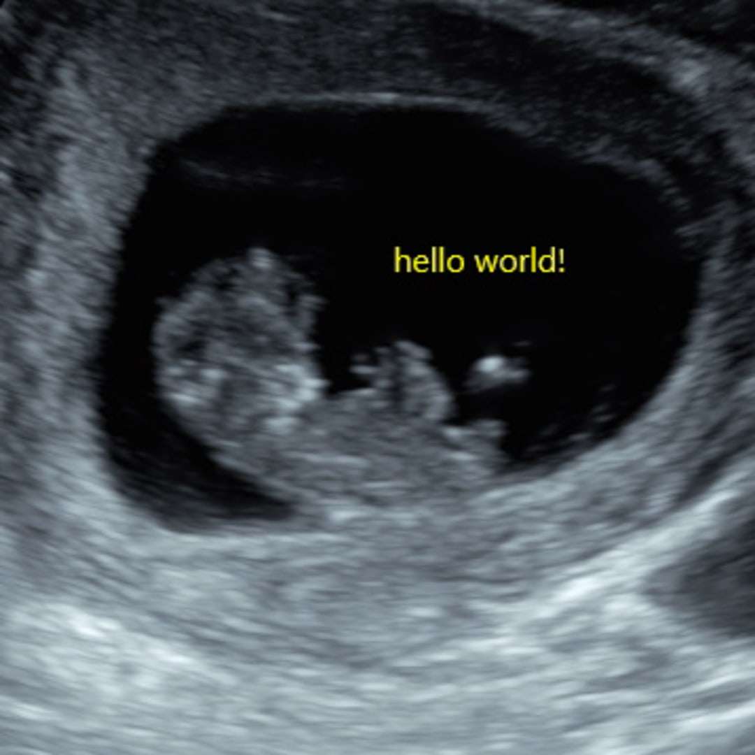 Photo shared by Cassie for their Babylist baby registry.
