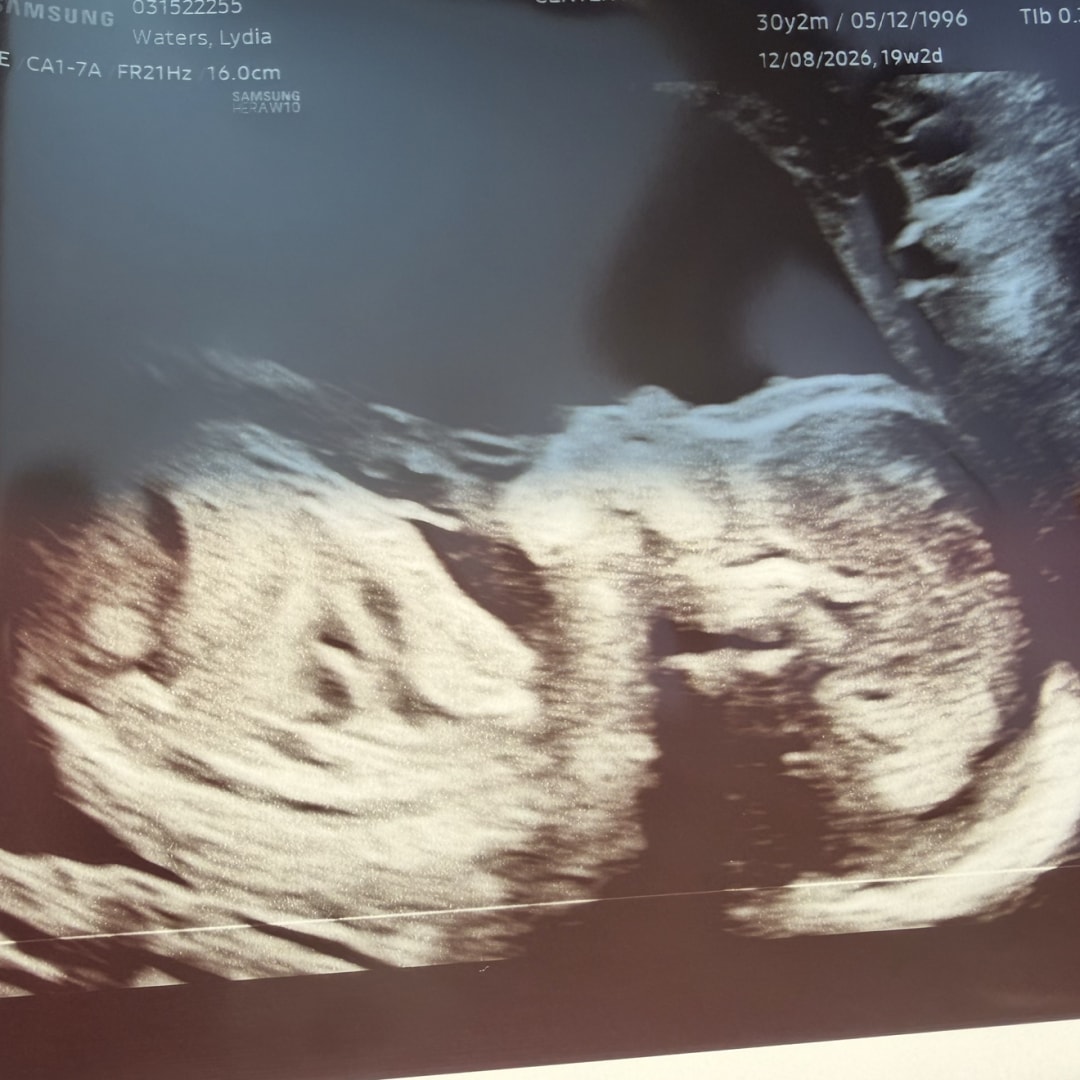 Photo shared by Lydia for their Babylist baby registry.