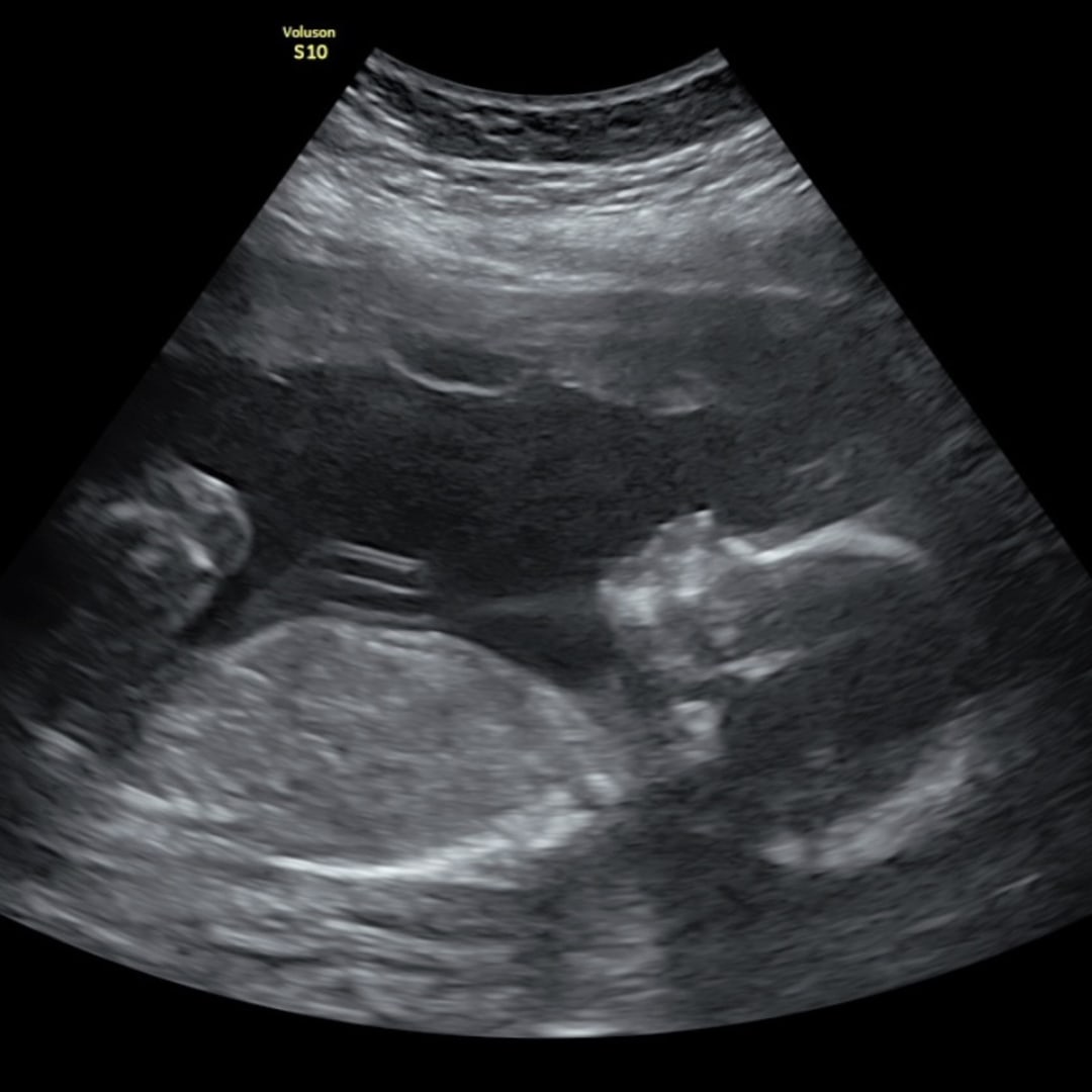 Photo shared by Kaitlyn for their Babylist baby registry.