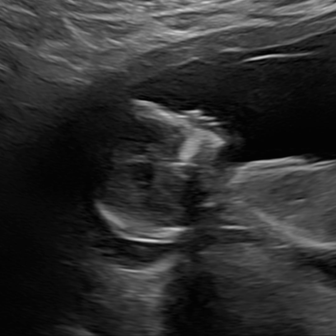 Photo shared by Skylar for their Babylist baby registry.