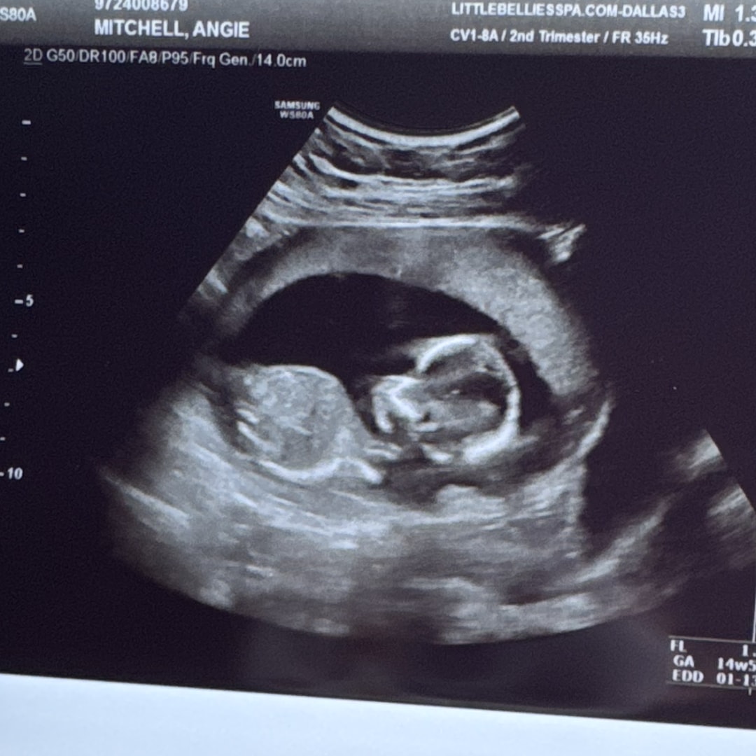 Photo shared by Angie for their Babylist baby registry.