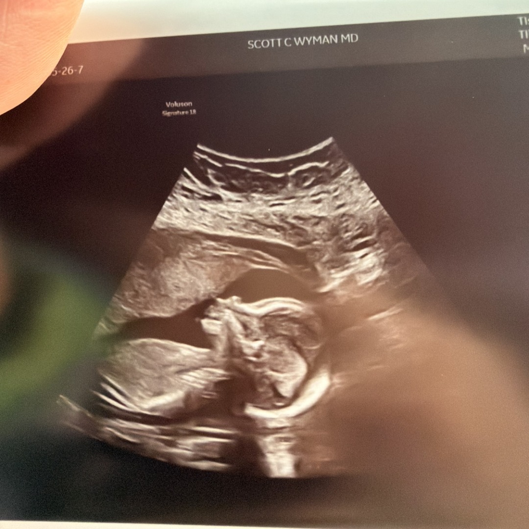 Photo shared by Mariah&Arlyn for their Babylist baby registry.