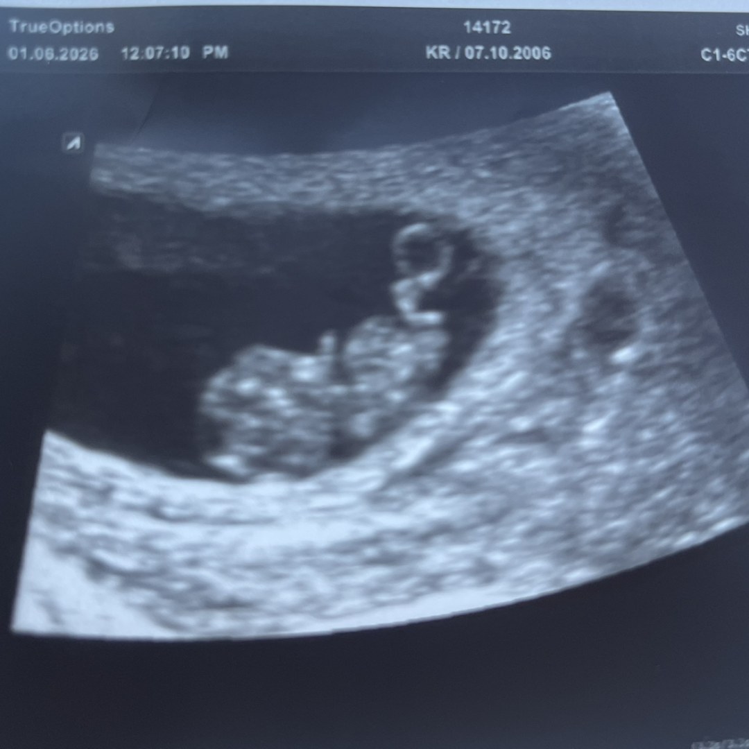 Photo shared by Karla for their Babylist baby registry.