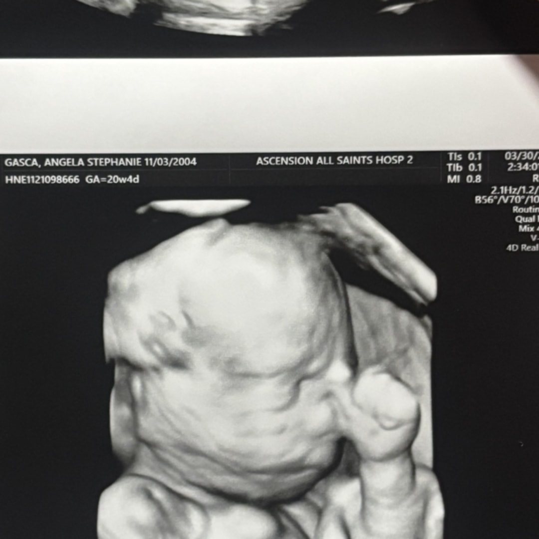 Photo shared by Angela for their Babylist baby registry.