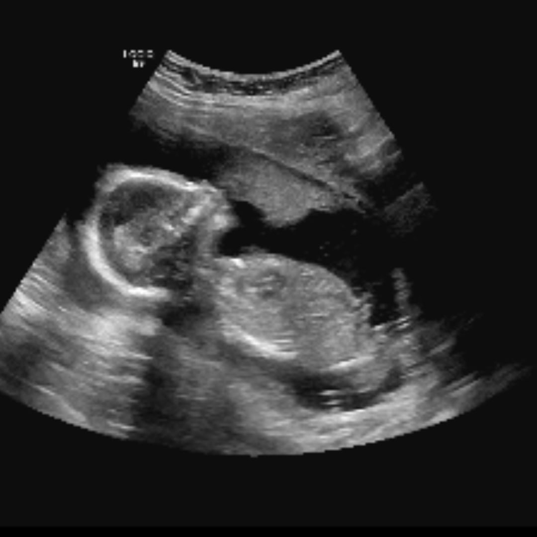 Photo shared by Priscila for their Babylist baby registry.