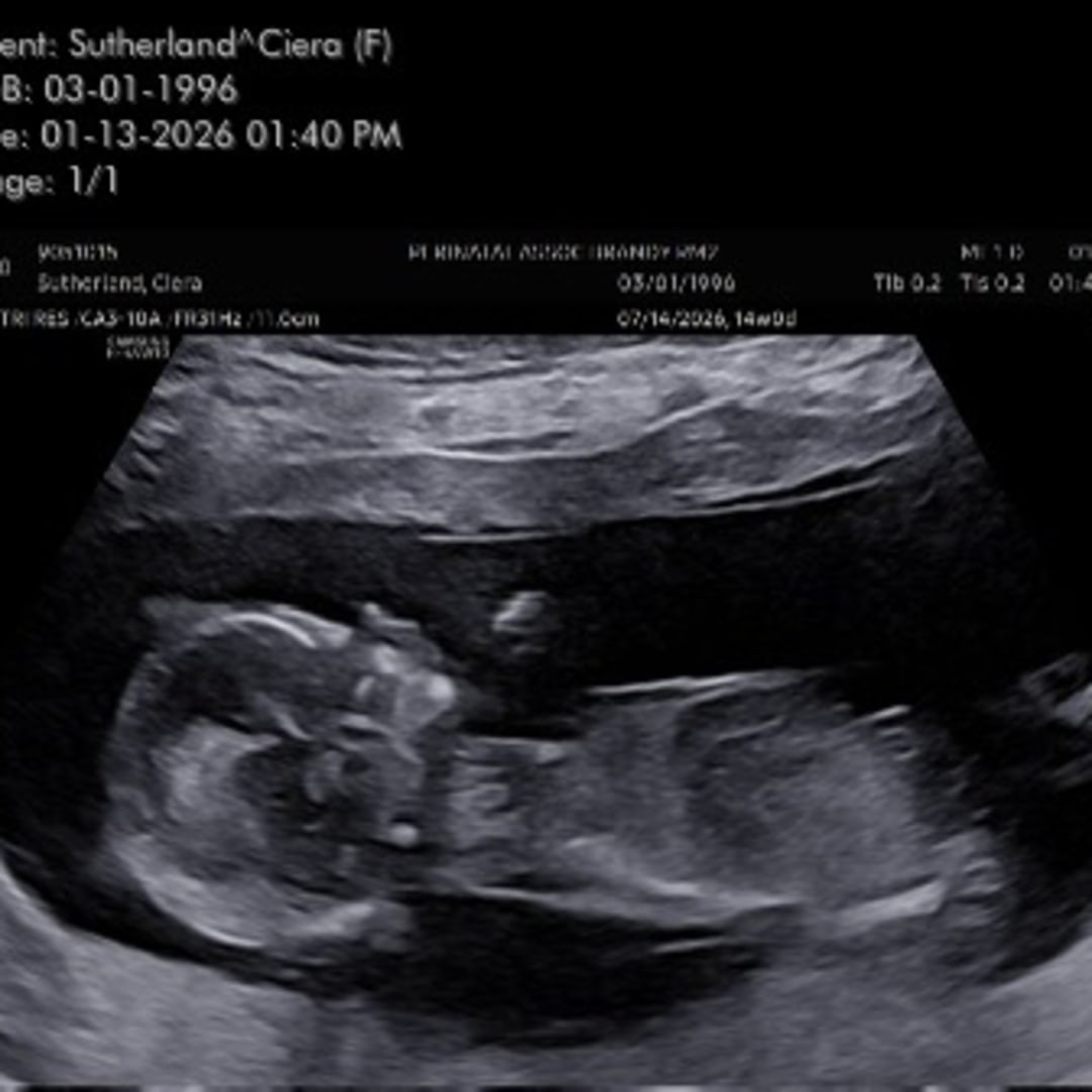 Photo shared by Ciera for their Babylist baby registry.