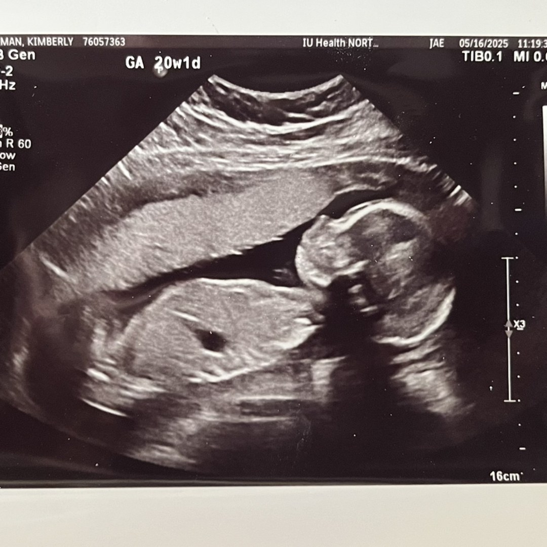 Photo shared by Kimberly for their Babylist baby registry.
