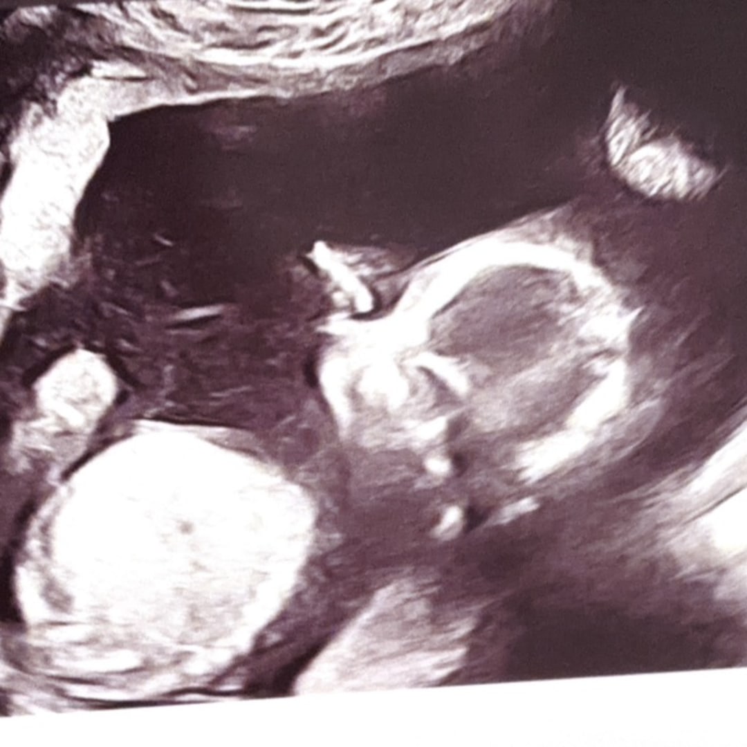 Photo shared by Ashlyn for their Babylist baby registry.