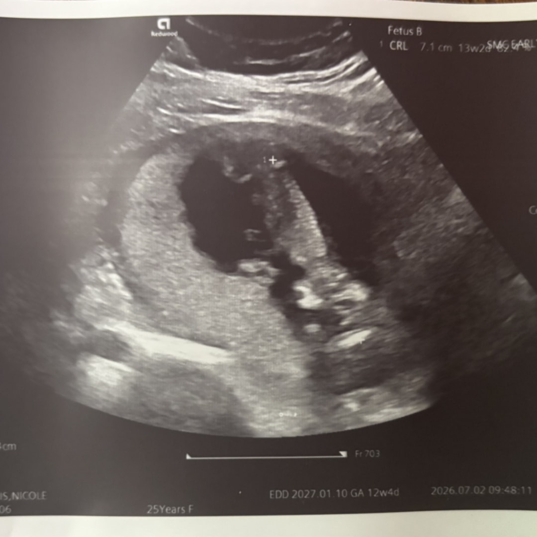Photo shared by Alexis for their Babylist baby registry.