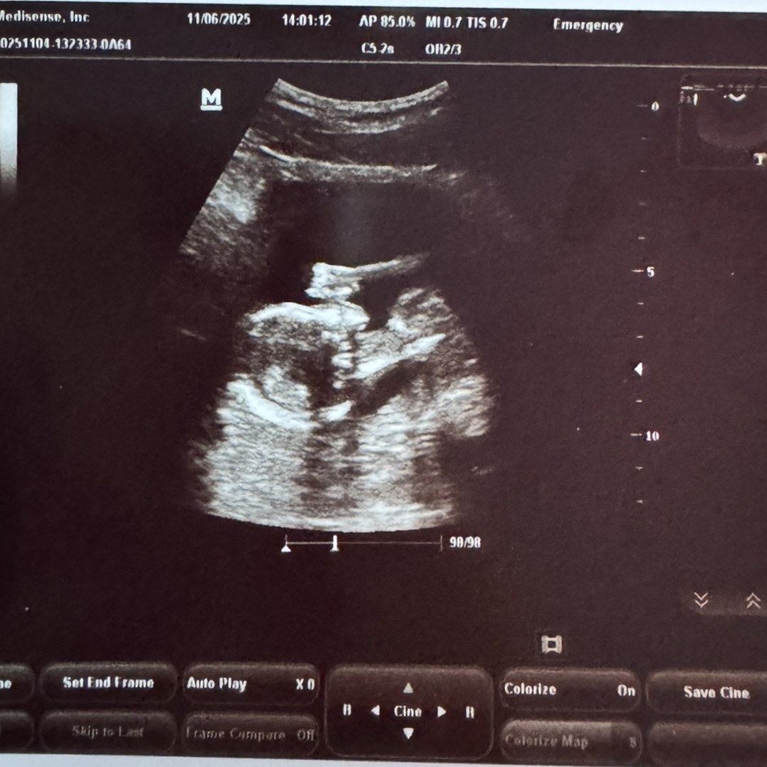 Photo shared by Keyanni for their Babylist baby registry.