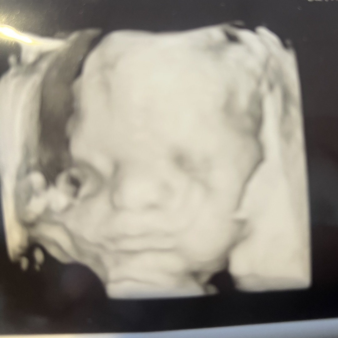 Photo shared by Ebony for their Babylist baby registry.