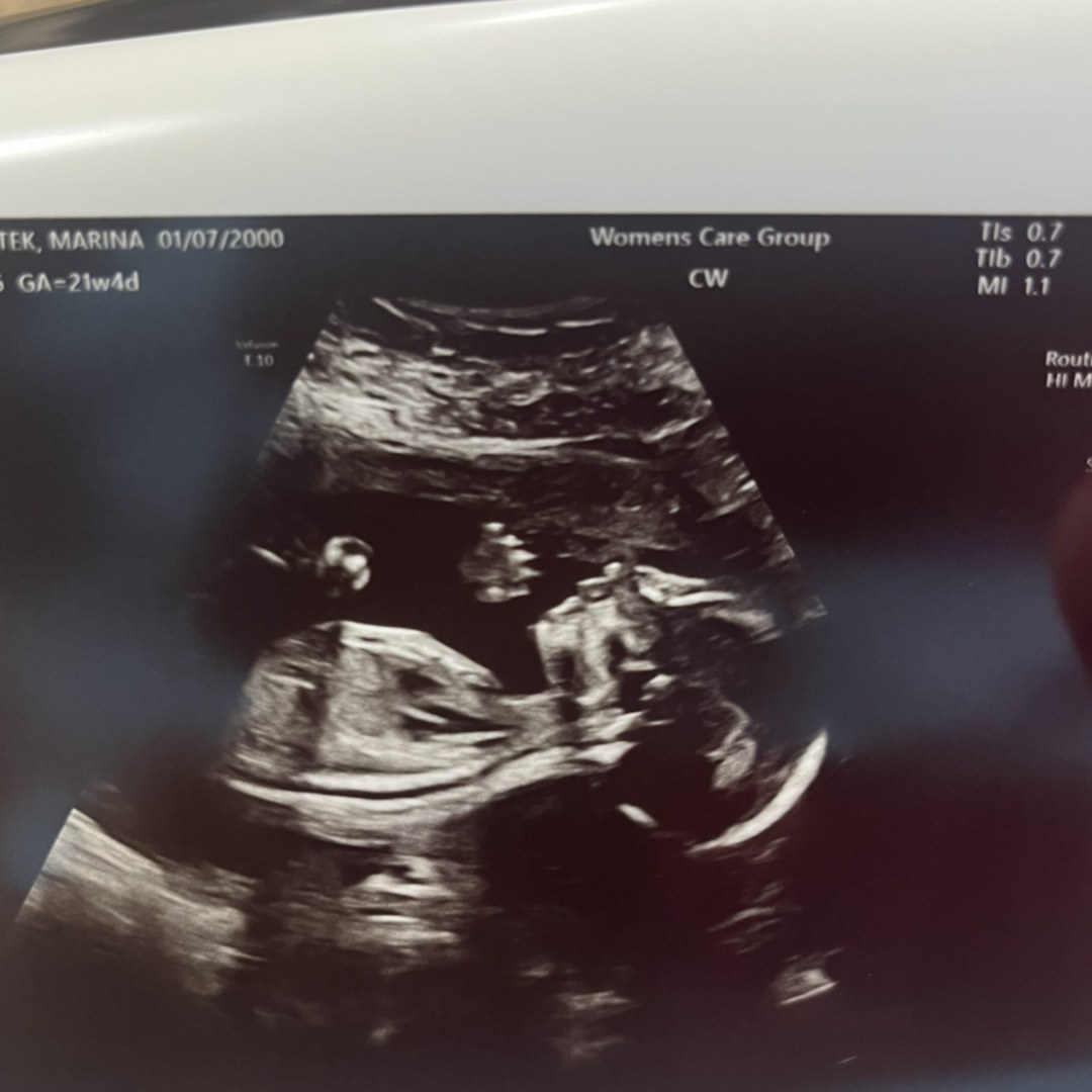 Photo shared by Marina for their Babylist baby registry.