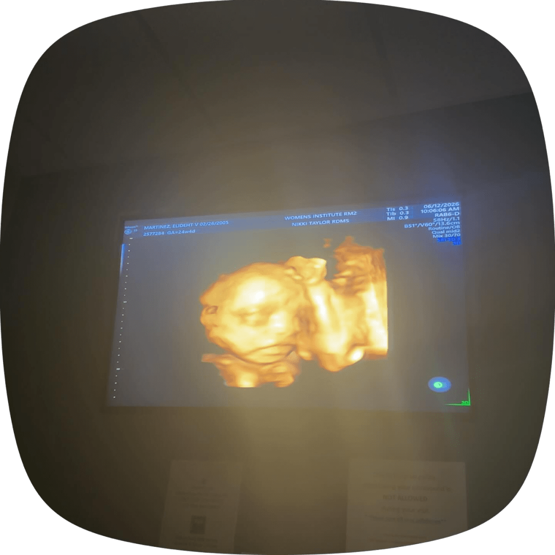 Photo shared by Elideht for their Babylist baby registry.