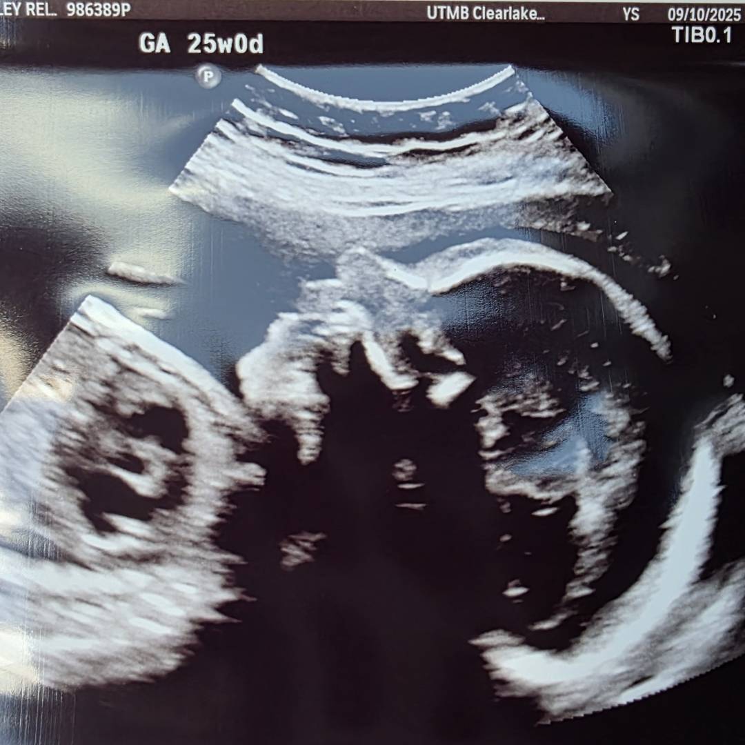 Photo shared by Ashley for their Babylist baby registry.