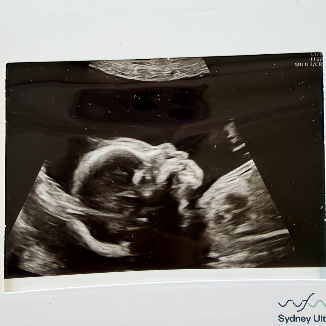 Photo shared by Heidi for their Babylist baby registry.