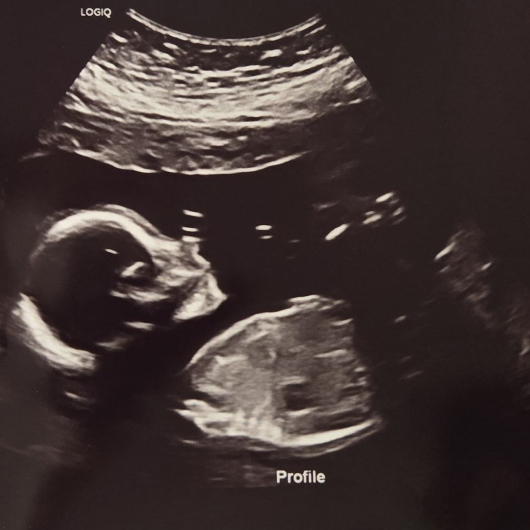 Photo shared by Jenna for their Babylist baby registry.