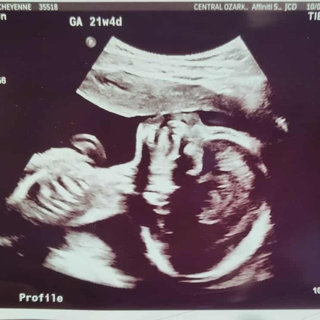 Photo shared by Cheyenne for their Babylist baby registry.