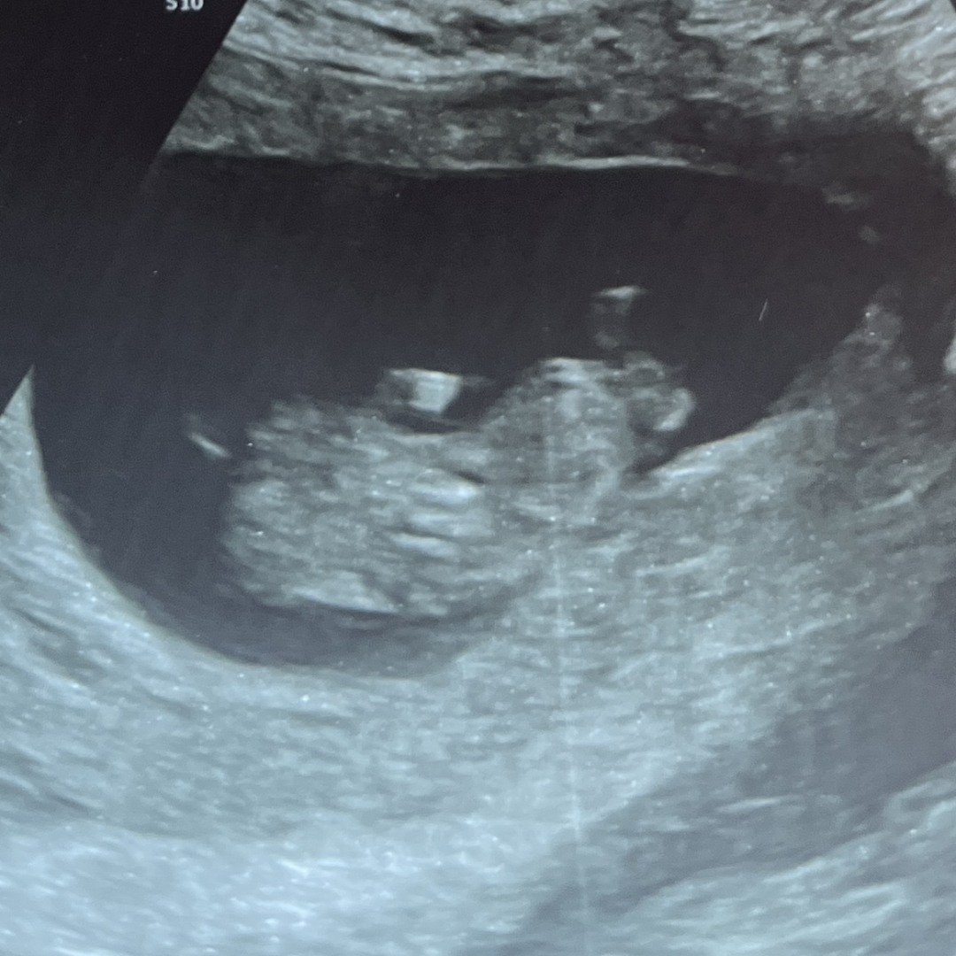 Photo shared by Devyn for their Babylist baby registry.