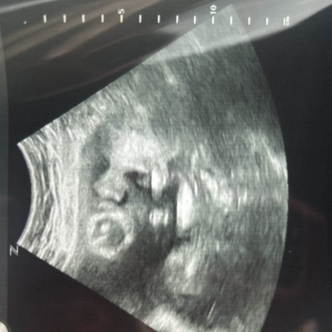 Photo shared by Marlene for their Babylist baby registry.