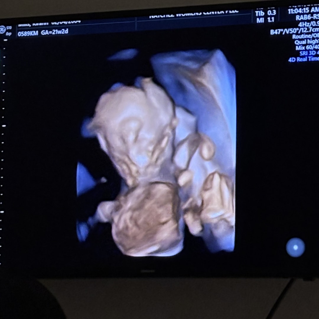 Photo shared by Kirahn for their Babylist baby registry.