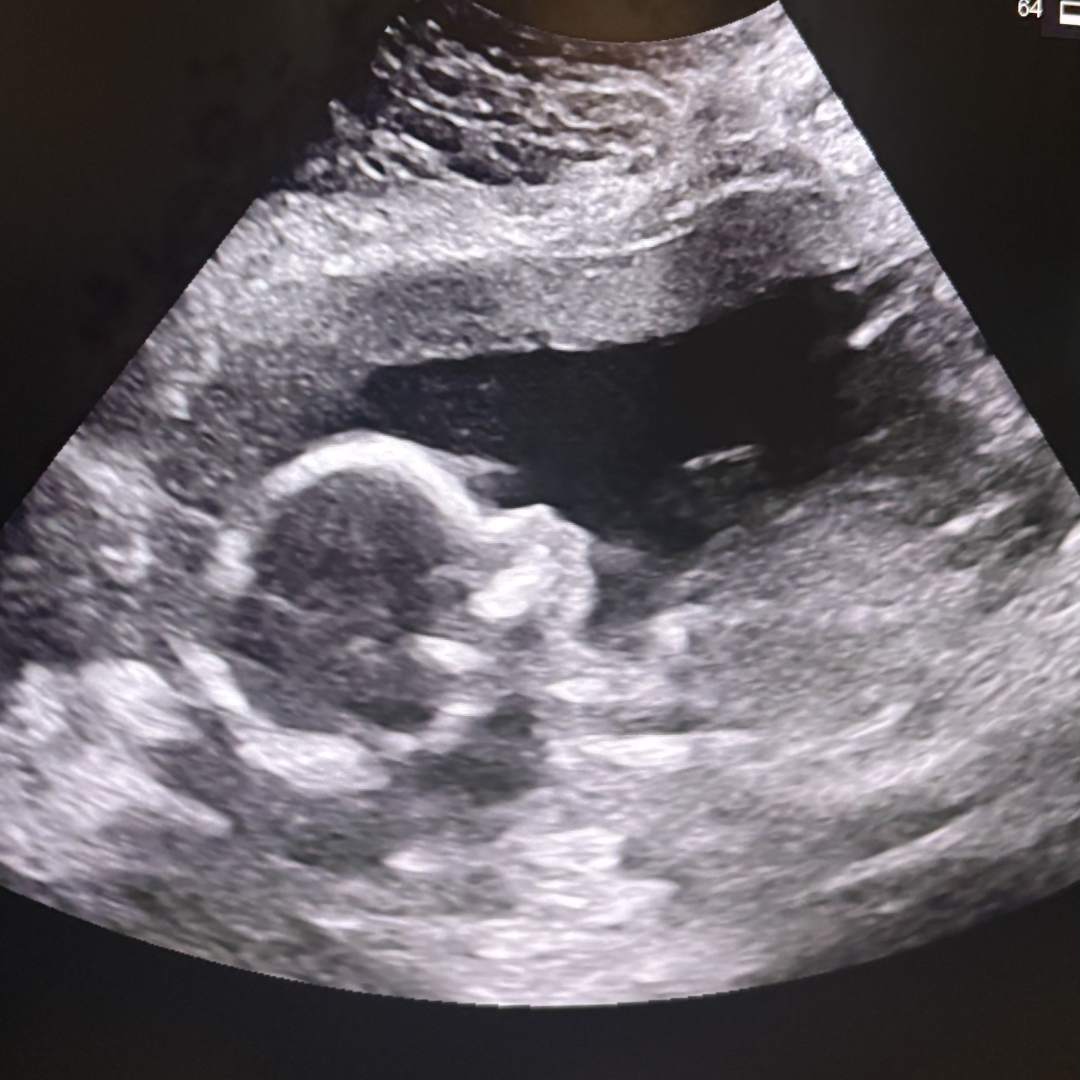 Photo shared by Maggie for their Babylist baby registry.