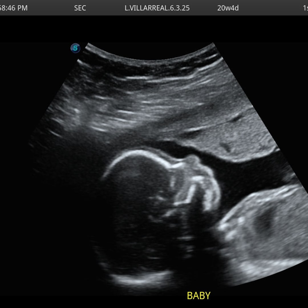 Photo shared by Lexi for their Babylist baby registry.